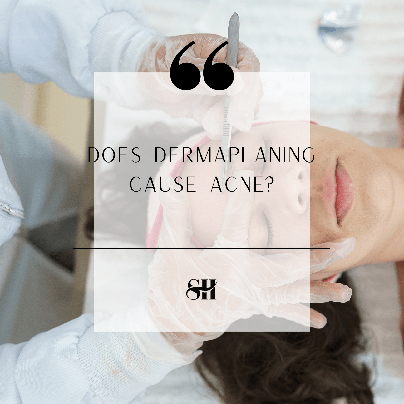 Does Dermaplaning Cause Acne?