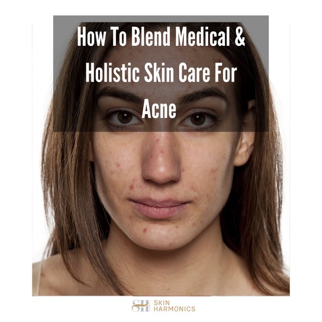 Medical & Holistic Skin Care For Acne