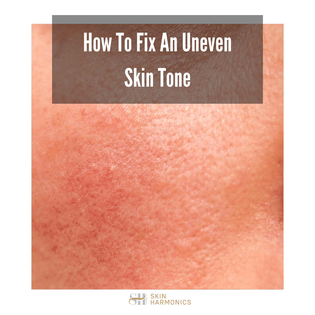 How To Fix An Uneven Skin Tone