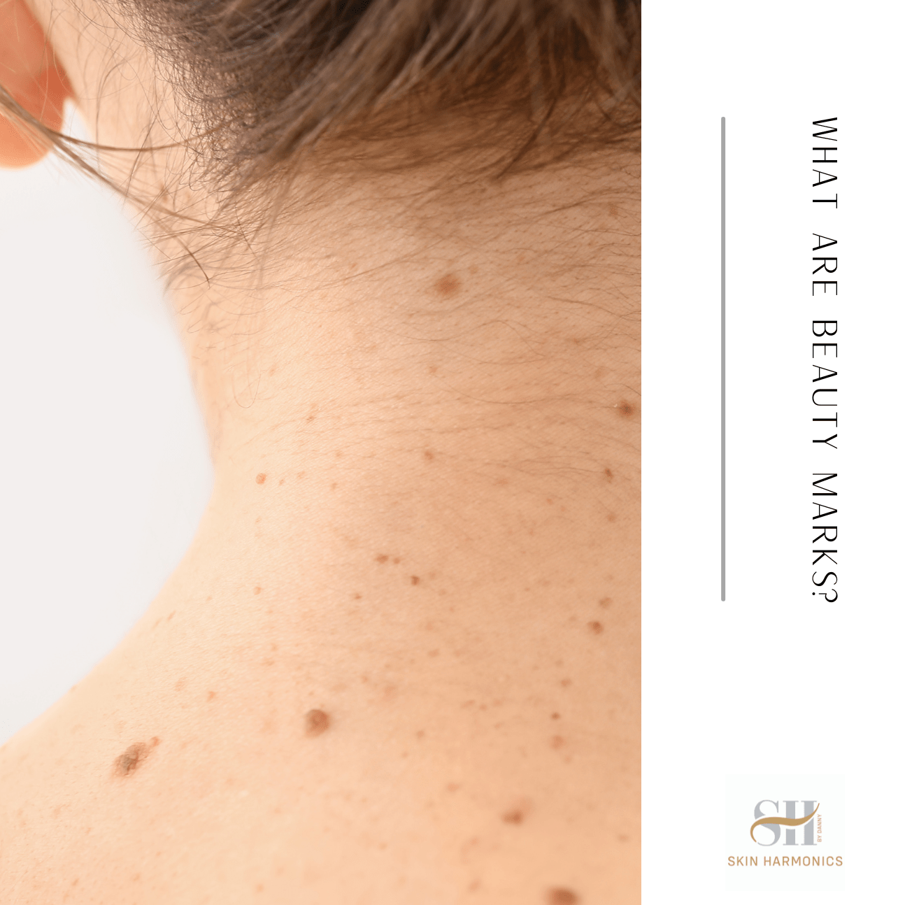 What Are Beauty Marks?