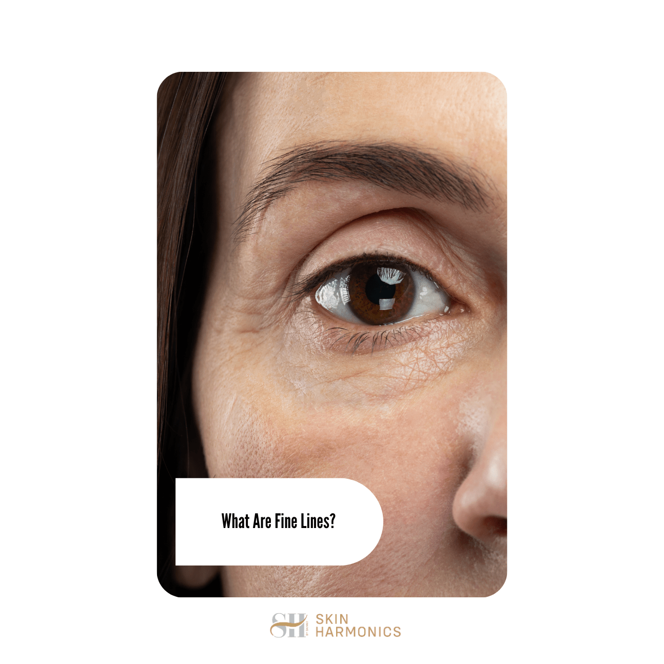 What Are Fine Lines?