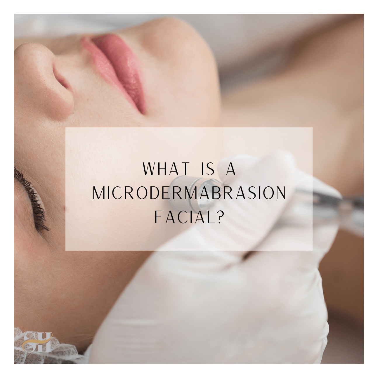 What Is A Microdermabrasion Facial?