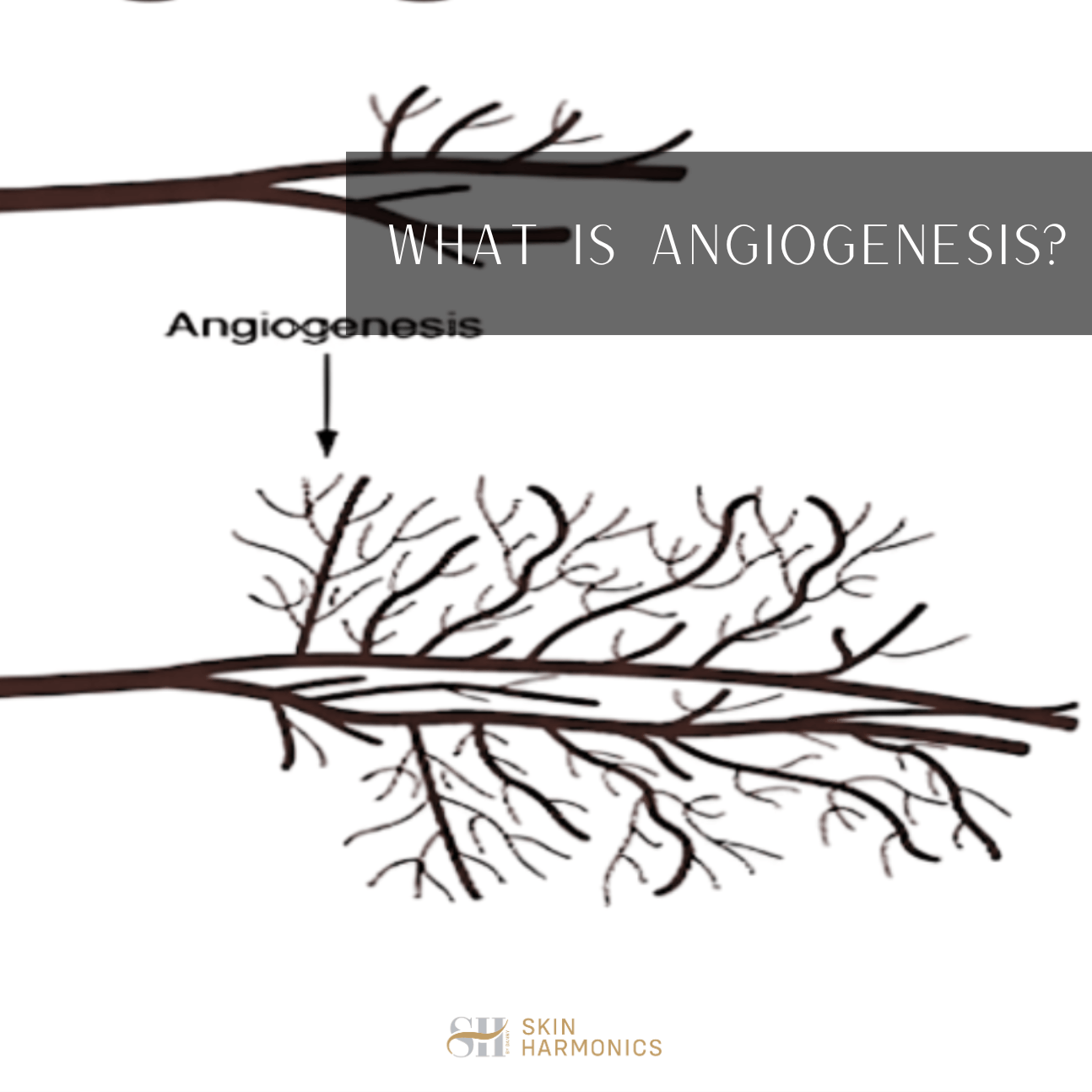 What Is Angiogenesis?