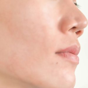 after skin Skin care clinic
